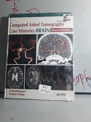 Computed Aided Tomography Case Histories BRAIN 
